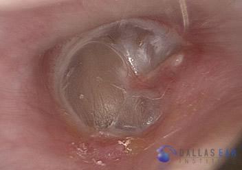 inner ear 1 (1)