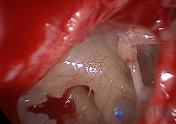 inner ear 2 (1)