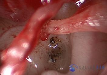 inner ear 4 (1)