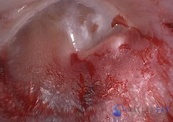 inner ear 7 (1)
