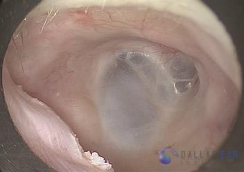 ocr-3-1