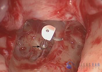 ocr-3-4