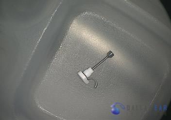 ossicular-chain-reconstruction-case-4