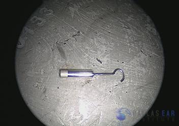 Stapes Image 3