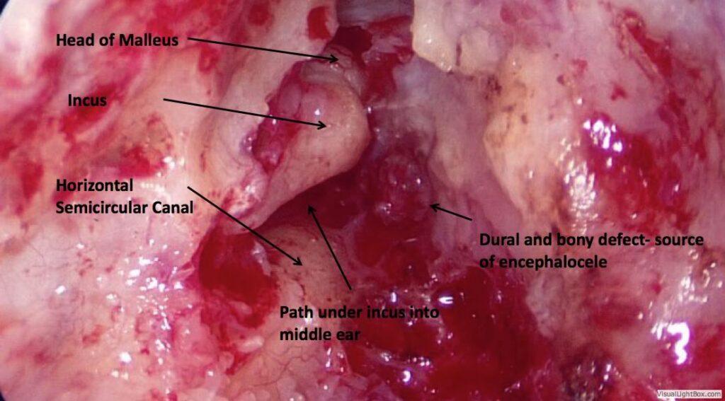 Various parts of the inner ear 2
