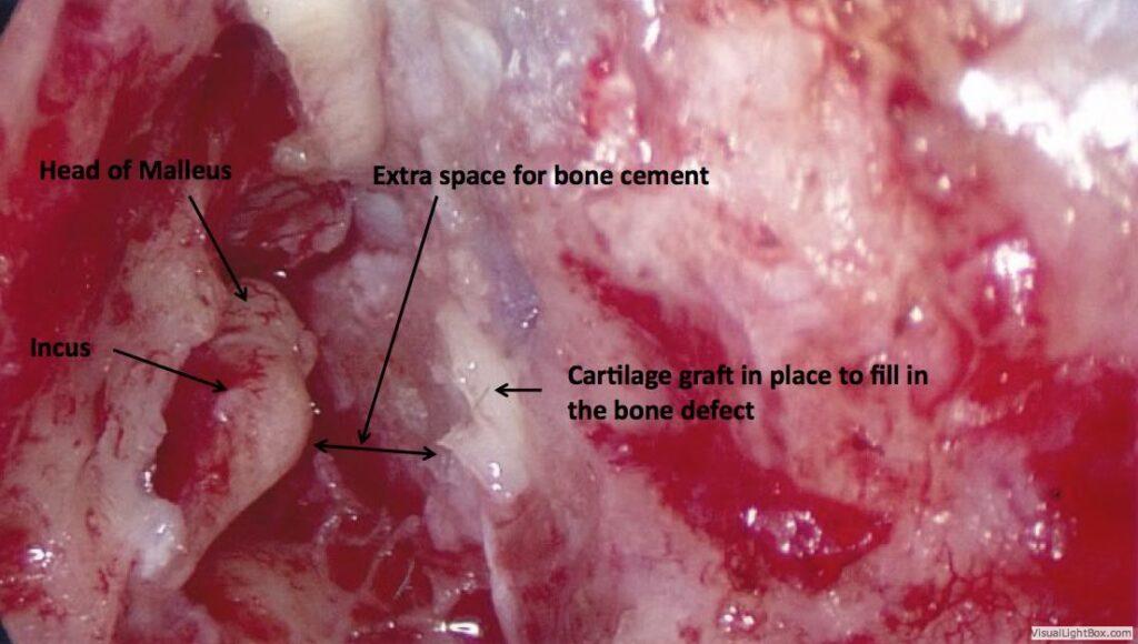 Various parts of the inner ear