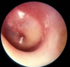 Inside the ear.