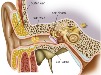 Earwax build up.